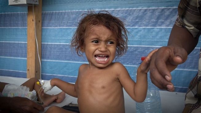 Im Kampf gegen Cholera: Jemens dramatische Lage